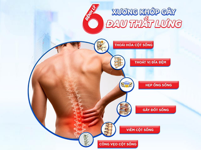 Đồ gia dụng Seka đau lưng